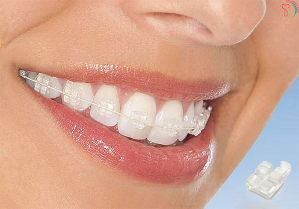 Giá khám nha khoa Bình Dương phụ thuộc vào loại hình dịch vụ sử dụng