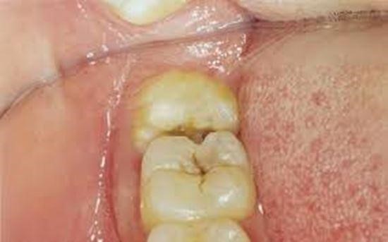 Tình trạng đau nhức răng miệng thường xuyên xảy ra ở bất cứ ai