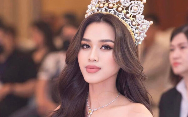 Như thế nào là mặt lưỡi cày và nguyên nhân do đâu? 2 Có tình trạng mặt hình lưỡi cày nhẹ và cũng có tình trạng nặng