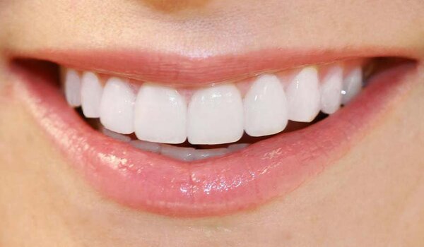 Răng vĩnh viễn là răng còn lại sau khi rụng răng sữa.